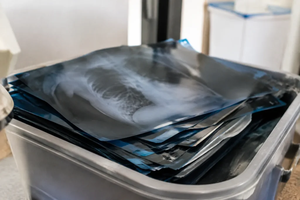 Films medicaux usages empiles sur un bac gris