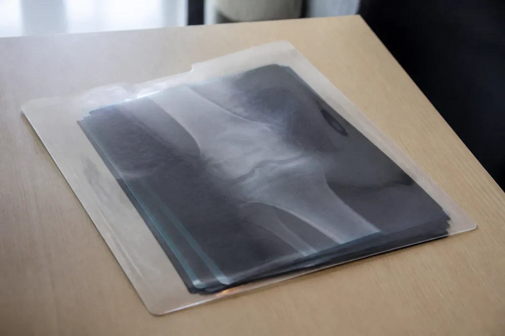 Pochette transparente de radiographies posee sur une table claire